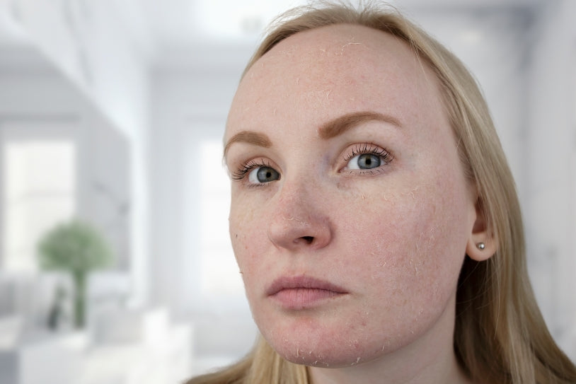 Woman with dry skin in a bathroom